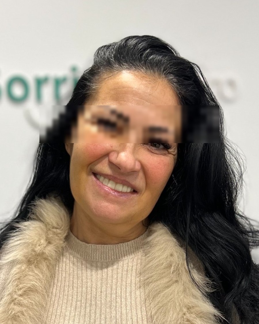 Rossana B. after treatment - Sorriso Sicuro